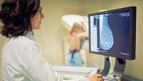 Po roku od zrušenia je mamografia späť - nárok na ňu majú opäť ženy už od 40 rokov: Čo všetko sa od 1. júla 2026 zmenilo v prevencii rakoviny prsníka